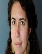 Dina Ezzat