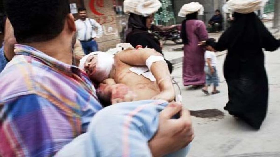 حلب میں ایک شخص لڑائی کے دوران زخمی ہونے والے بچے کو اٹھائے لے جا رہا ہے