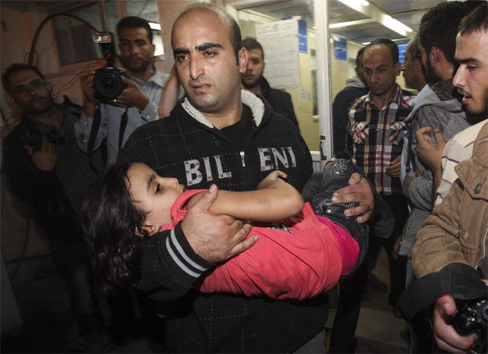 طفلة جريحة من ضحايا القصف الاسرائيلي على غزة