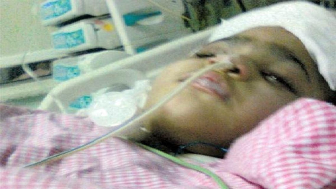 لمی انتقال سے قبل اہسپتال کے انتہائی شعبہ نگہداشت میں داخل