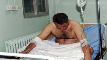 دمشق میں بدھ کو ہوئے ایک بم دھماکے کا زخمی اسپتال میں زیرعلاج ہے۔