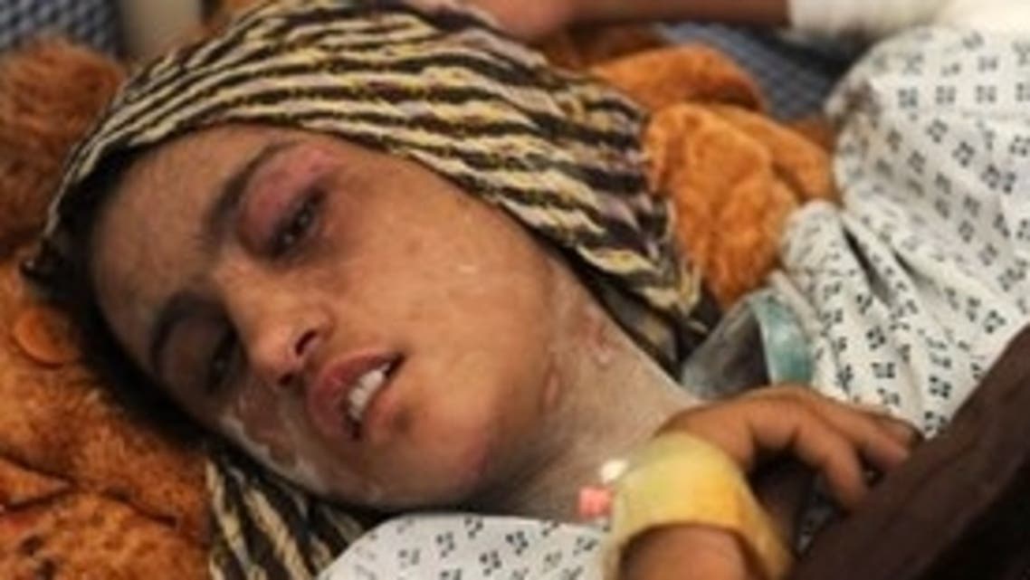 Sahar's injuries caused public outcry in Afghanistan AFP