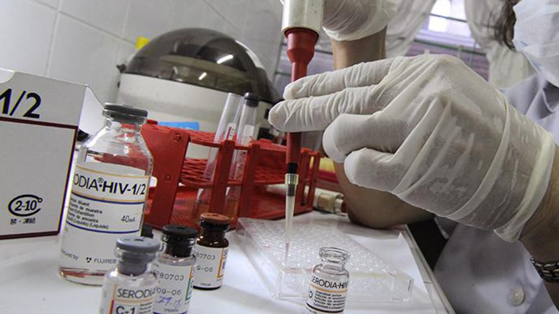 hiv afp