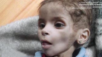 طفلة فلسطينية في مخيم اليرموك تنتظر إنقاذها من الموت