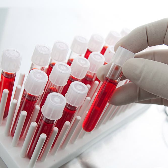  طفرة علمية لمكافحة السرطان.. فحص دم يكشف 50 نوعا قبل أعراضه