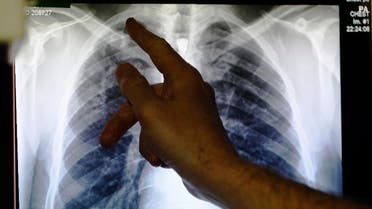 mers virus reuters