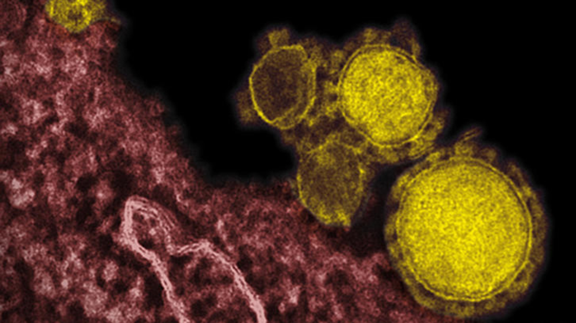 Mers