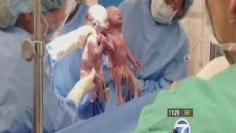 فيديو مؤثر.. طفلة تخرج من بطن أمها ممسكة بيد أختها 