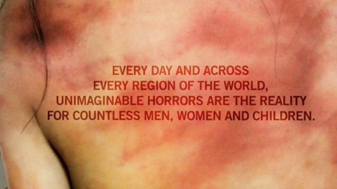 Amnesty torture