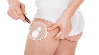 Cellulite, be gone! Banish the dreaded dimples with these tricks