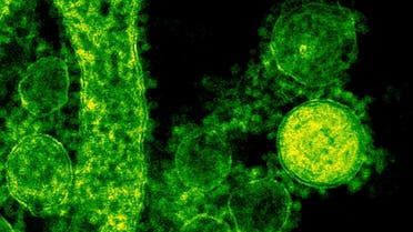 Particles of the Middle East respiratory syndrome (MERS) coronavirus that emerged in 2012 are seen in an undated colorized transmission electron micrograph. (Reuters)