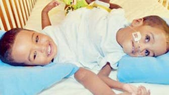 Conjoined twins now breathe separate lives after surgery in Saudi Arabia 