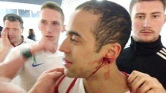 Footage shows England fan losing ear in Brazil attack