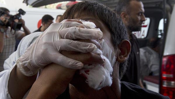 طفل اصيب في وجهه اثر قصف منزله في غزة