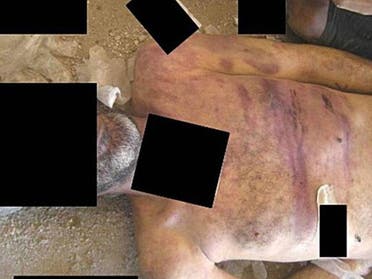 صور معتقلين ماتوا تحت التعذيب في سجون سوريا