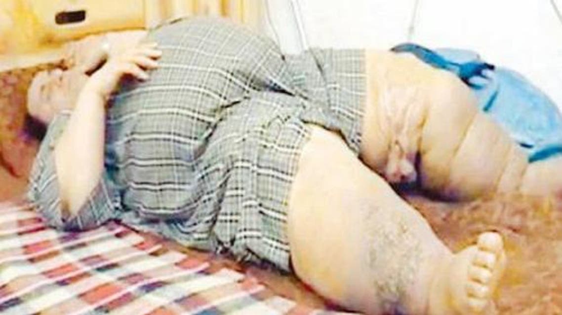 obese saudi man