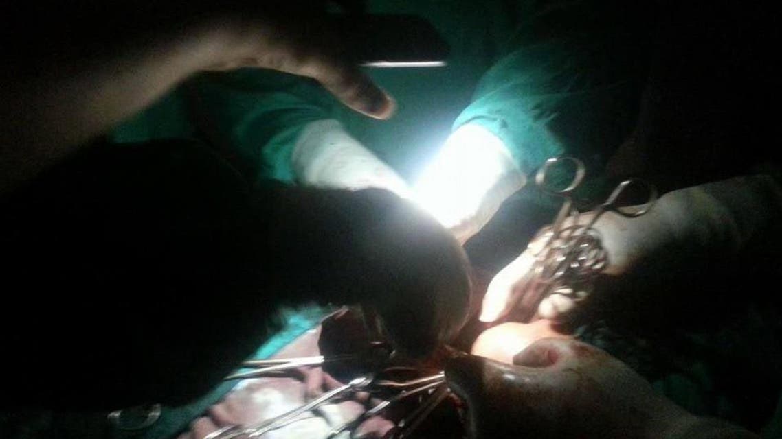 عملية جراحية في مصر على ضوء الجوال بعد انقطاع الكهرباء