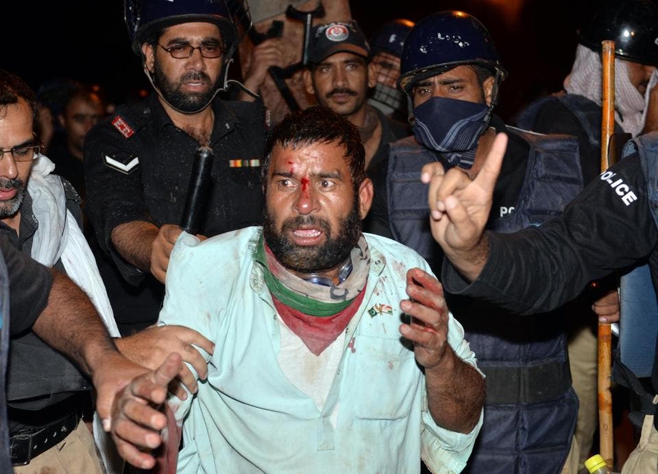 injured pakistan afp
