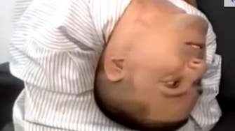 Brazilian man born with head upside-down defies odds 
