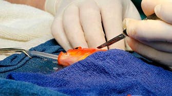 George the goldfish has 'high risk' brain surgery 