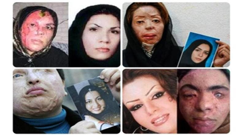 'Bad hijab' linked to acid attacks on Iranian women - Al 