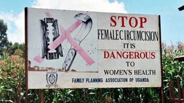 fgm