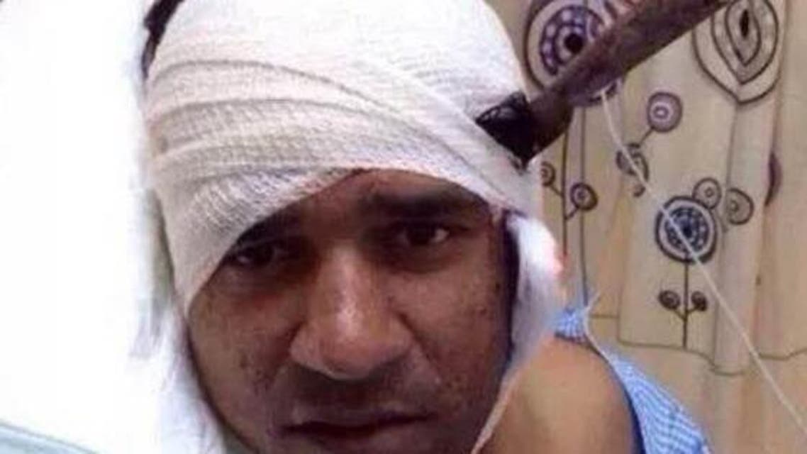عامل مطعون في رأسه
