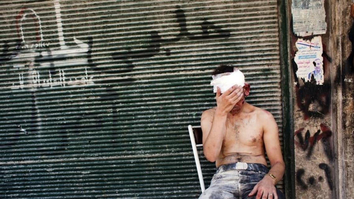 A man wounded by shelling sits on a chair outside a closed shop in the Al-Muasalat area of Aleppo, Syria. (File photo: AFP)