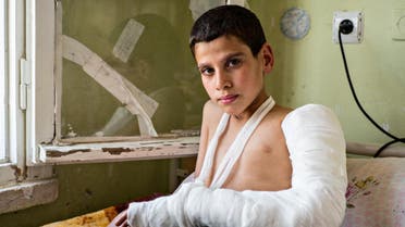 طفل مصاب بشظية في حلب