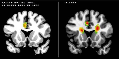 In love brain Twitter