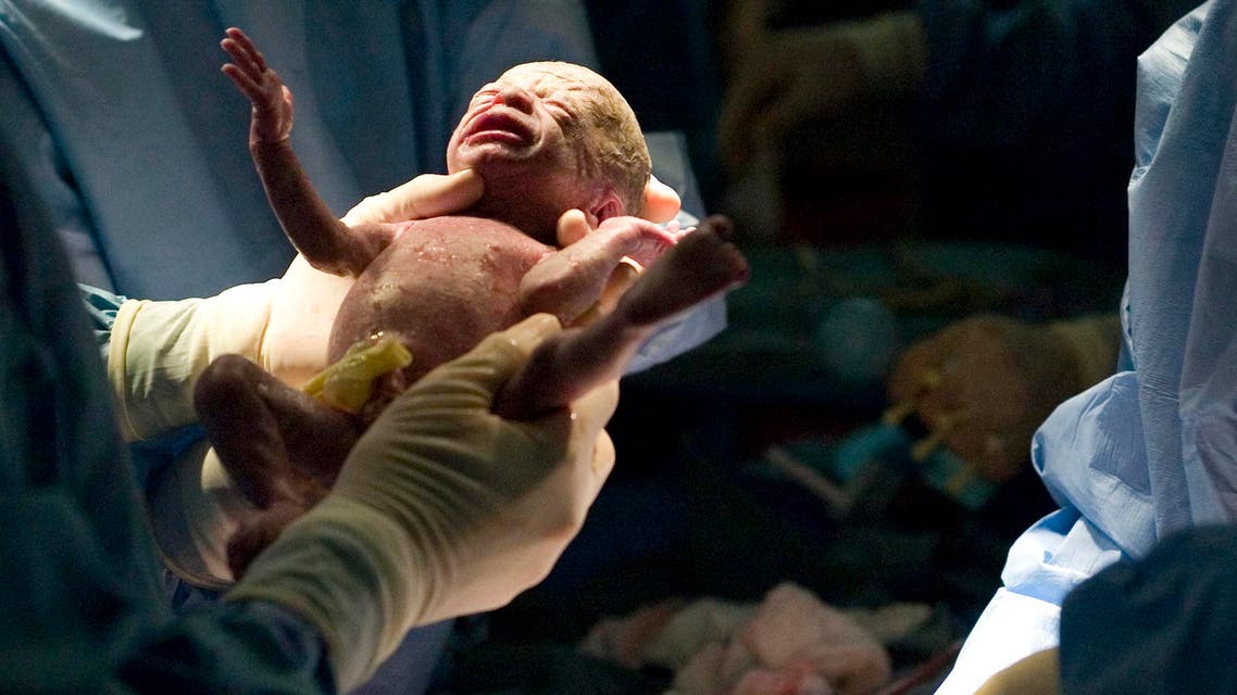 Doctors shows Jenny Masche one of her sextuplets, baby E, born Monday, June 11, 2007, in Phoenix, Ariz. Hospital officials say Masche, 32, gave birth by Caesarean section at Banner Good Samaritan Hospital in central Phoenix to three boys and three girls. The babies were born prematurely after 30 weeks and four days, and all but one weighed less than three pounds. (AP Photo/The Arizona Republic, Catherine J. Jun)