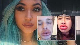 New ‘Kylie Jenner challenge’ sees teens trying to get bigger lips