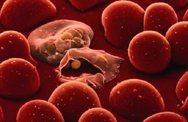 طفيليات الملاريا تنقلها البعوضة عبر لعابها وتفتك بكريات الدم الحمراء ويتضخم معها الطحال