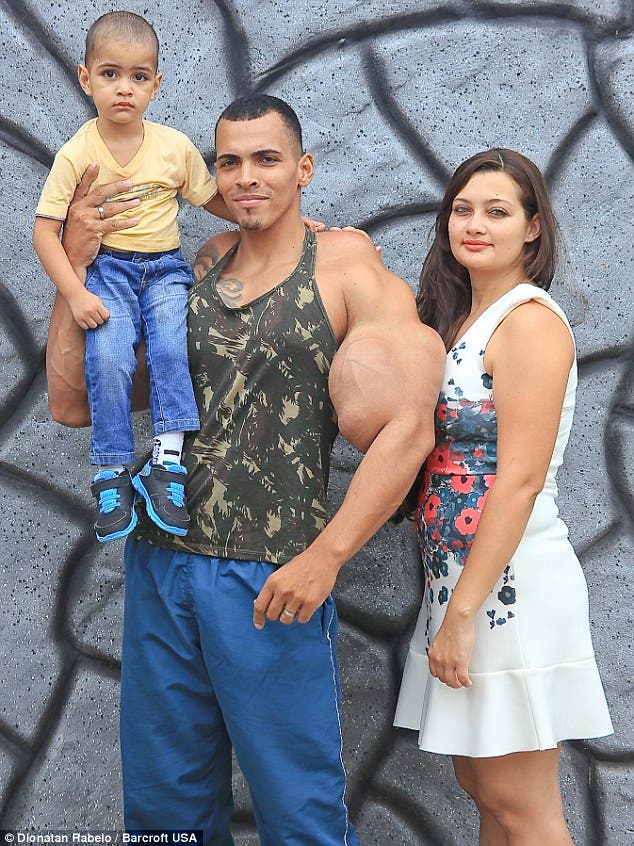 Meet the real life Hulk who injected himself with of oil and alcohol