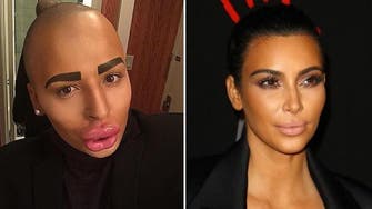 Kardashian fan spends $150,000 to look like his favorite star