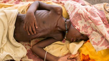 A severally malnourished child lies on the bed at MSF hospital Bentiu, South Sudan, Thursday, July 3, 2014. Acute malnutrition and water born diseases are the main contributors to poor children’s health in Bentiu camp. Another issue is the lack of water with most only receiving 7-8 litres a day of fresh water, many turn to water from unsafe sources. (AP Photo/Matthew Abbott)
