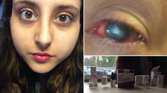 Student with parasite in her eye forced to stay awake for a week 