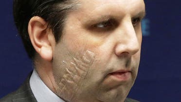 U.S. Ambassador to South Korea Mark Lippert listens to a question during a press conference before being discharged from Severance Hospital in Seoul, South Korea, Tuesday, March 10, 2015. (AP)