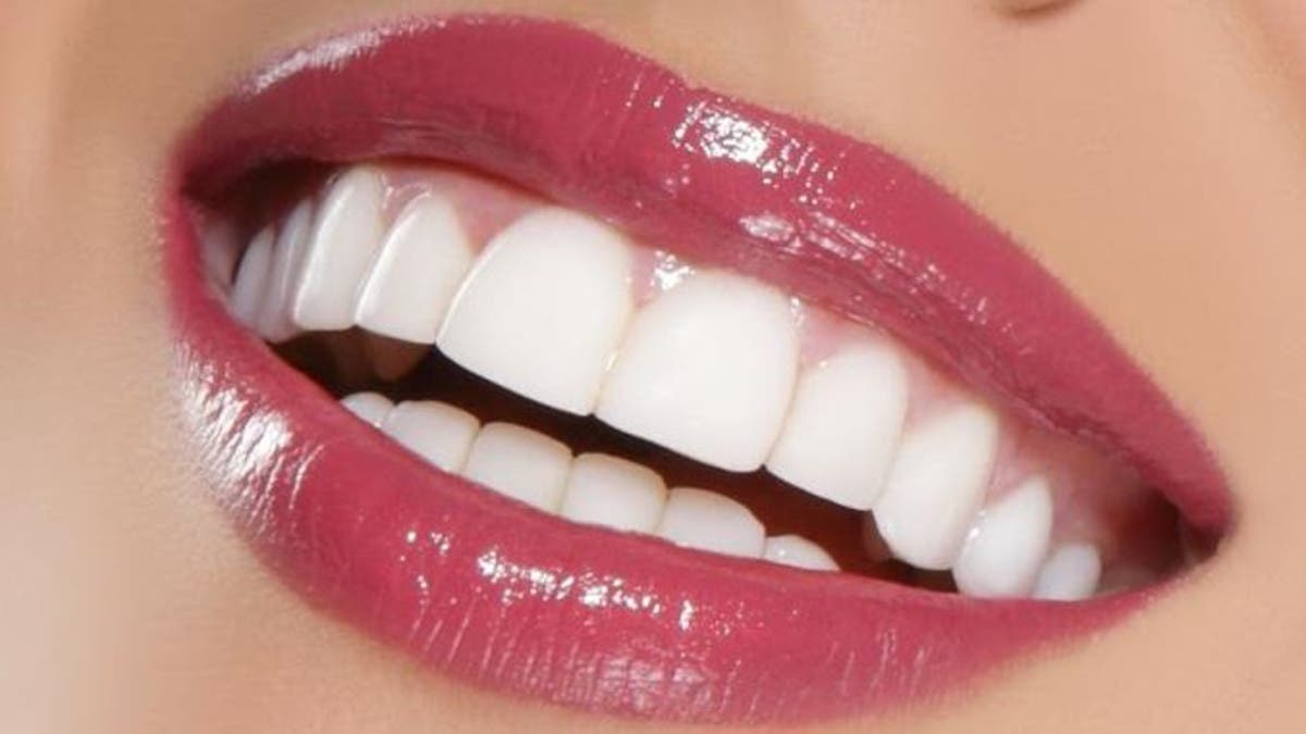 ابتسامة هوليوود موضة باتت حلا للكثير من مشاكل الأسنان