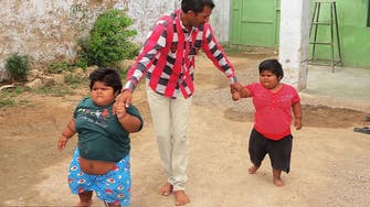 Obese sisters walk for the first time after shedding a stone each