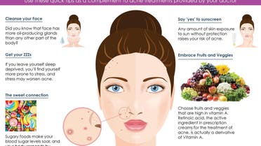 Infographic: Simple tips to fight acne