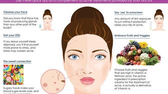 Simple tips to fight acne