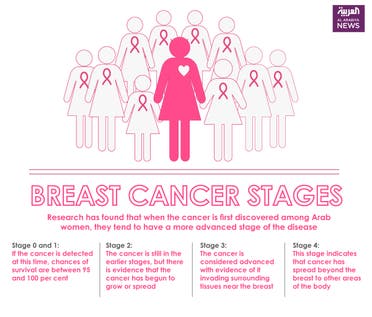 Infographic: Breast cancer stages