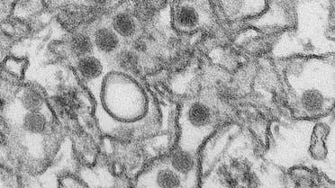A transmission electron micrograph (TEM) shows the Zika virus, in an undated photo provided by the Centers For Disease Control in Atlanta, Georgia. (Reuters)