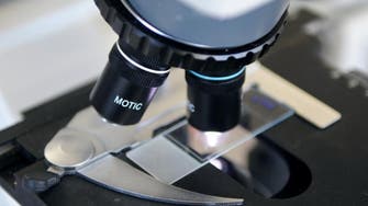 A single cell's change gives insight on cancer's origin