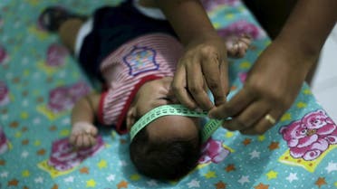 Guilherme Soares Amorim, 2 months, who was born with microcephaly, gets his head measured by his mother Germana Soares, at her house in Ipojuca, Brazil, February 1, 2016. reuters