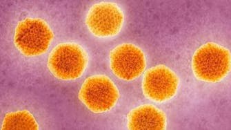 First death related to Zika virus seen in continental US 