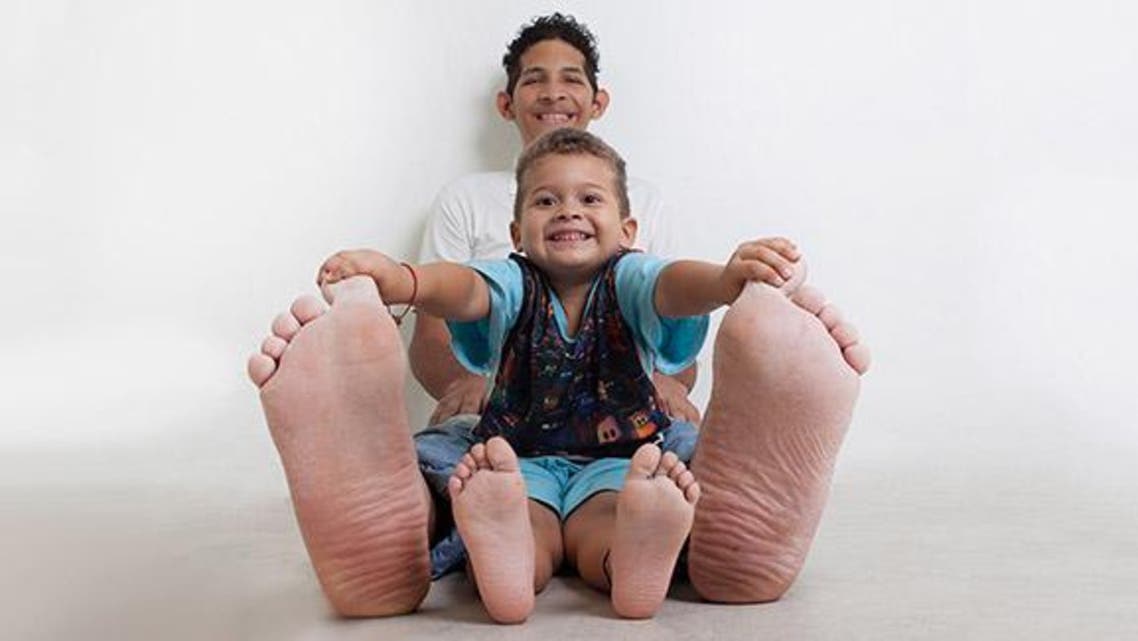 Jeison Rodriguez finds it virtually impossible for the Venezuelan man who holds the record for the world’s largest feet. (Photo courtesy: Guinness World Records)