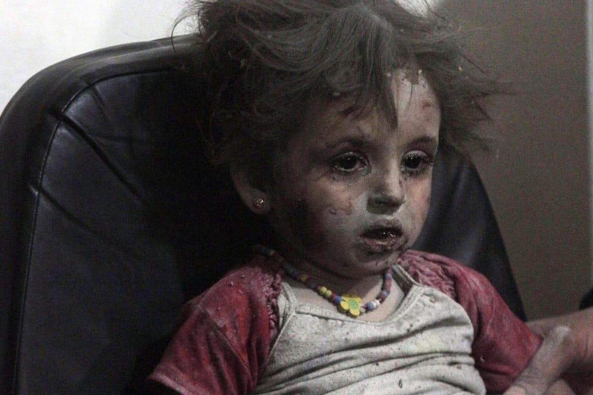 An injured child rests in a field hospital after what activists claim were at least five air strikes carried out by regime forces in Douma, eastern al-Ghouta, September 11, 2014. (Reuters)