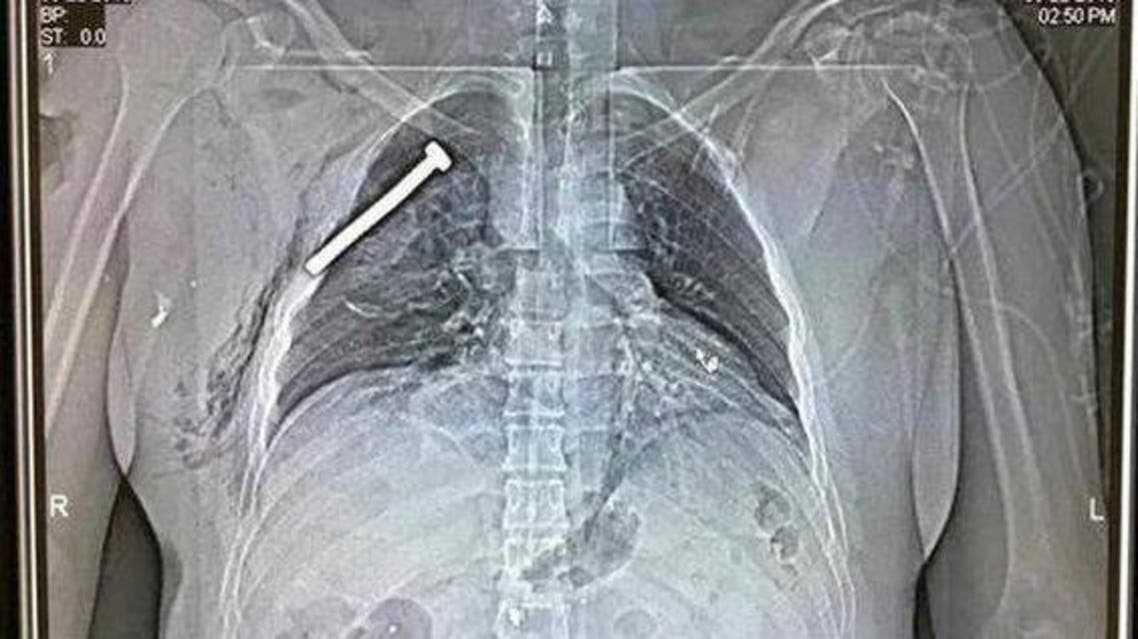 (Photo courtesy Neder-over-Heembeek Military Hospital)